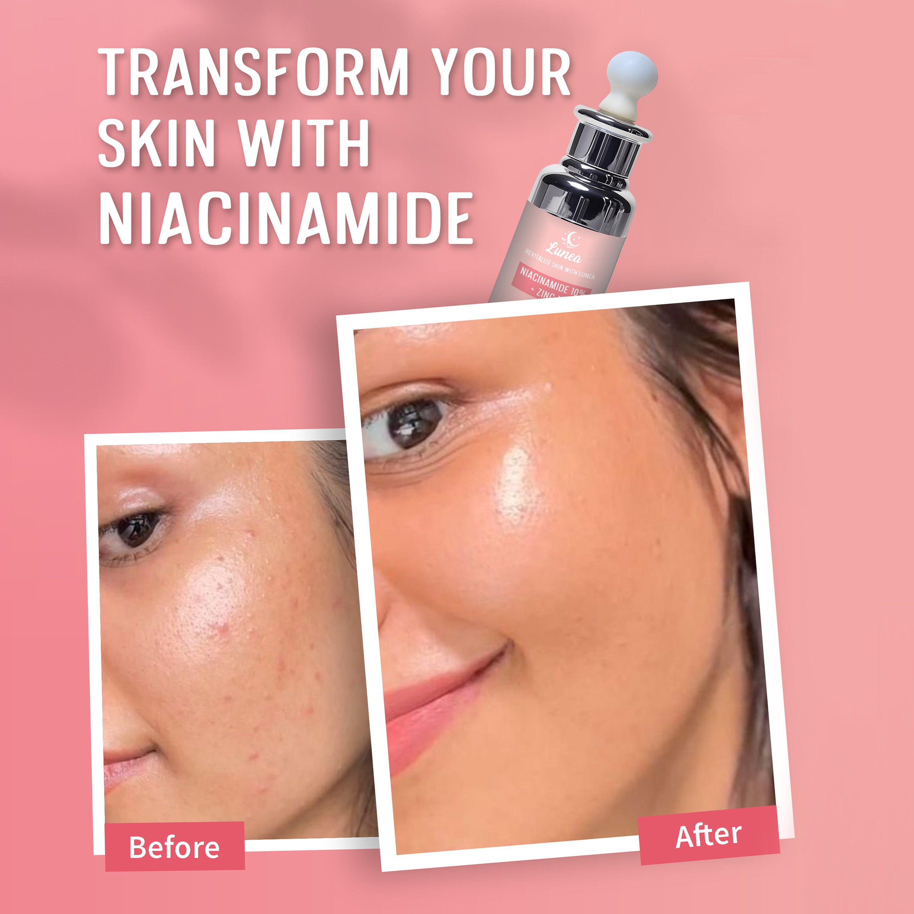 Niacinamide + Zinc Serum