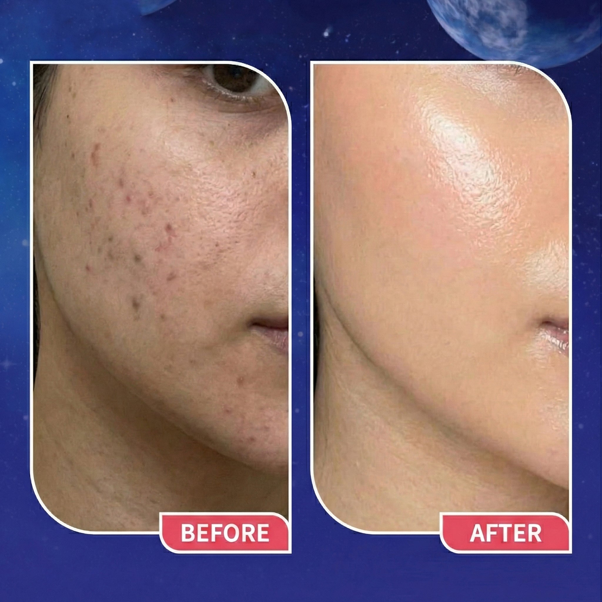 Retinol Night Serum